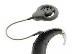 Audífono digital e implante coclear del oído.